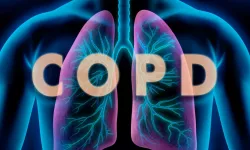 COPD